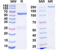 SDS-PAGE for Anti-DNA Antibody (74.122)