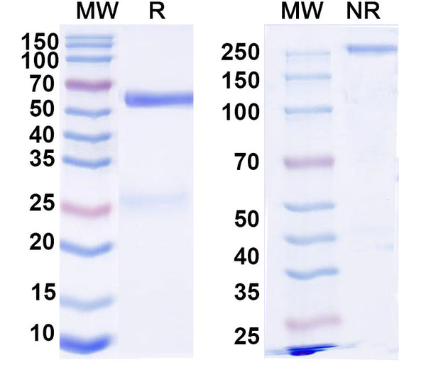 SDS-PAGE for Anti-DNA Antibody (74.122)