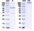 SDS-PAGE for Anti-DNA Antibody (163.1)