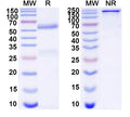 SDS-PAGE for Anti-DNA Antibody (202.135)