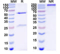 SDS-PAGE for Anti-DNA Antibody (17s.13)