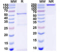 SDS-PAGE for Anti-DNA Antibody (III-2R)