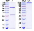SDS-PAGE for Anti-DNA Antibody (2E3#)