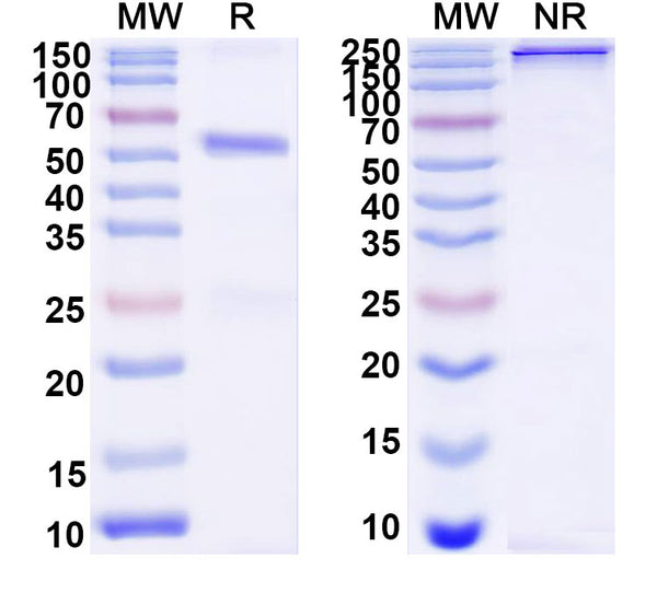 SDS-PAGE for Anti-DNA Antibody (3E12#)