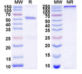 SDS-PAGE for Anti-DNA Antibody (DP1)