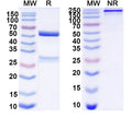 SDS-PAGE for Anti-DNA Antibody (S7)