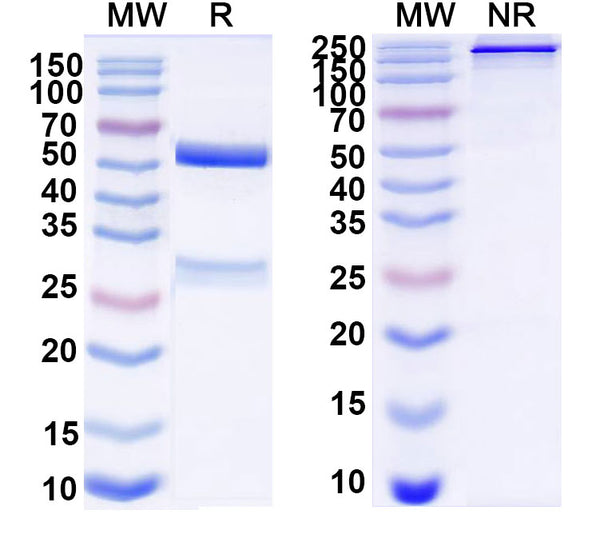 SDS-PAGE for Anti-DNA Antibody (S41)