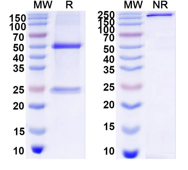 SDS-PAGE for Anti-DNA Antibody (2A4)