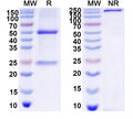 SDS-PAGE for Anti-DNA Antibody (BV17-31)