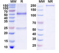 SDS-PAGE for Anti-DNA Antibody (DNA9)