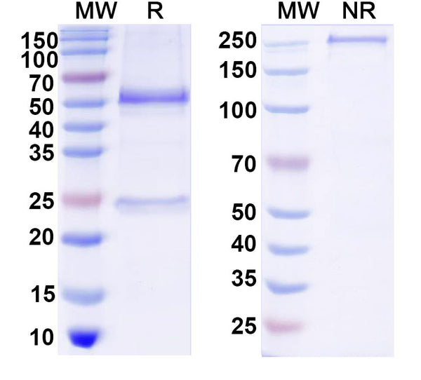 SDS-PAGE for Anti-DNA Antibody (DNA2)