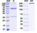 SDS-PAGE for Anti-DNA Antibody (563)