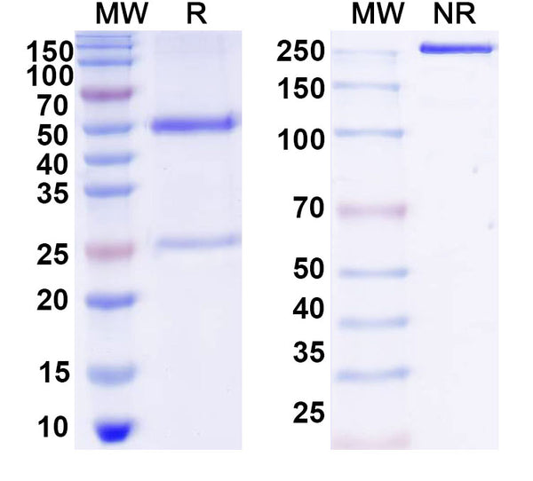 SDS-PAGE for Anti-DNA Antibody (567)