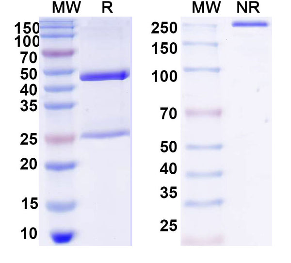 SDS-PAGE for Anti-DNA Antibody (5)