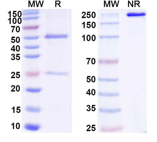 SDS-PAGE for Anti-DNA Antibody (12)