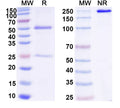 SDS-PAGE for Anti-DNA Antibody (D42)