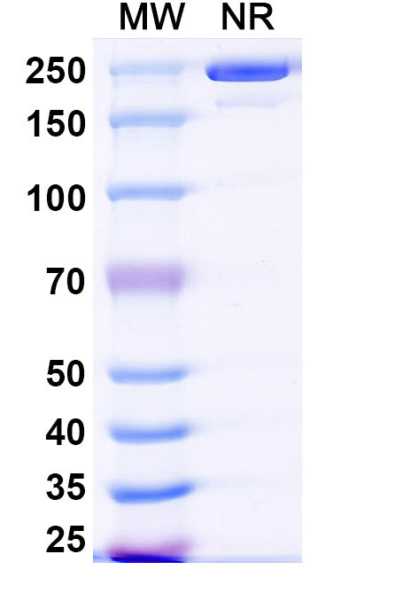 SDS-PAGE for Anti-DNA-RNA Hybrid Antibody(S9.6).