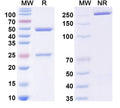 SDS-PAGE for Anti-Ganglioside GM1/2/3 Antibody (A3).