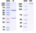 SDS-PAGE for Anti-Progesterone Antibody (1E9#)