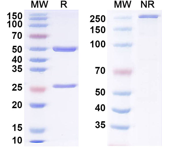 SDS-PAGE for Anti-Progesterone Antibody (1E9#)