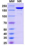 SDS-PAGE for Anti-Flag Tag (DYKDDDDK) Antibody (M2).