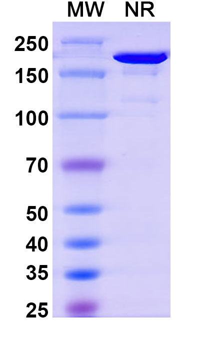SDS-PAGE for Anti-Flag Tag (DYKDDDDK) Antibody (M2).
