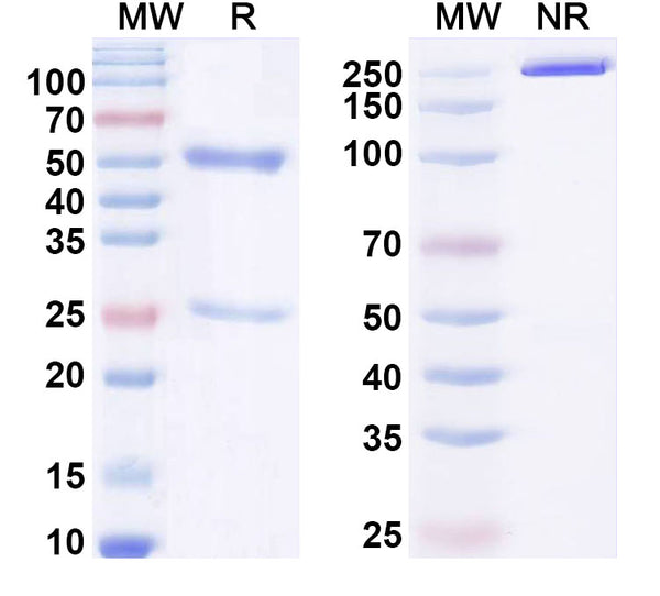 SDS-PAGE for Anti-ChoP/Phosphorylcholine Antibody (McPC603).