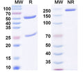 SDS-PAGE for Anti-dsDNA/ssDNA Antibody (A52).