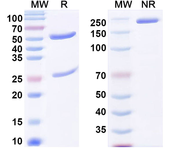 SDS-PAGE for Anti-dsDNA/ssDNA Antibody (A52).