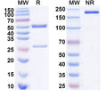 SDS-PAGE for Anti-Ganglioside GM1 Antibody (WO1)