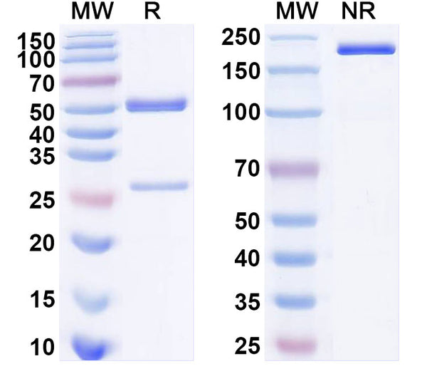 SDS-PAGE for Anti-Ganglioside GM1 Antibody (WO1)