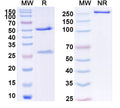 SDS-PAGE for Anti-Ganglioside GM1 Antibody (WO1)