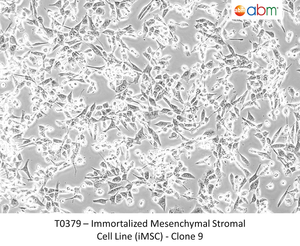 Immortalized Mesenchymal Stromal Cell Line (iMSC) - Clone 9 – Figure 1 of 1