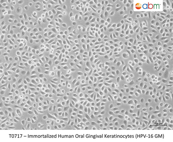Immortalized Human Oral Gingival Keratinocytes (HPV-16 GM) – Figure 1 of 1