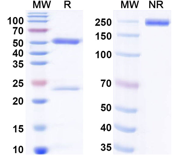 SDS-PAGE for Anti-Human PDPN/Podoplanin Antibody (SAA0514)