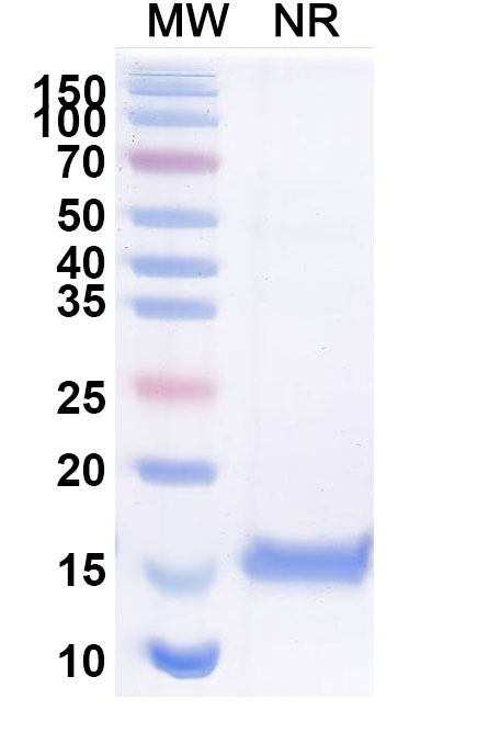 SDS-PAGE for Anti-BC2-tag (PDRKAAVSHWQQ) Nanobody (SAA1411)