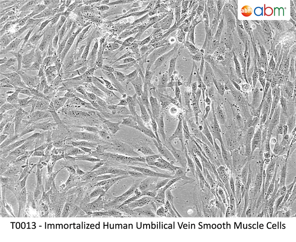 Immortalized Human Umbilical Vein Smooth Muscle Cells – Figure 1 of 1