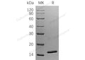 Recombinant Human SNU13 Protein (His Tag) – Figure 1 of 2