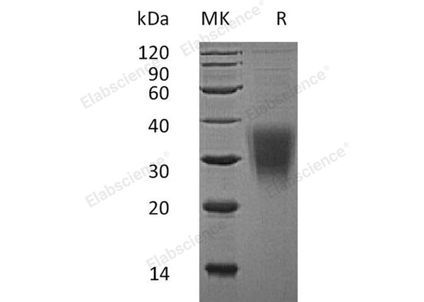 Recombinant Human CD159a/KLRC1 Protein (His Tag) – Figure 1 of 2