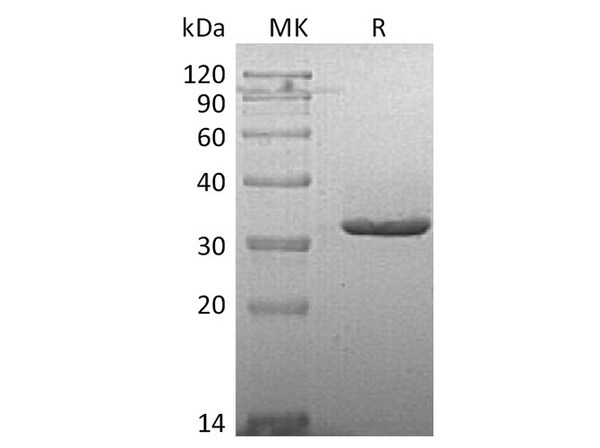 Recombinant Human IgG2-Fc Protein – Figure 1 of 2
