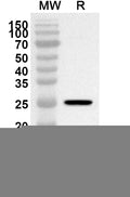 Western blot analysis was performed using anti-Zebrafish TLR4/tlr4al polyclonal antibody at 1ug/mL on recombinant Zebrafish TLR4/tlr4al (Catalog No. ZP032012).