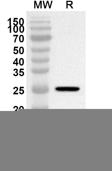 Western blot analysis was performed using anti-Zebrafish TLR4/tlr4al polyclonal antibody at 1ug/mL on recombinant Zebrafish TLR4/tlr4al (Catalog No. ZP032012).