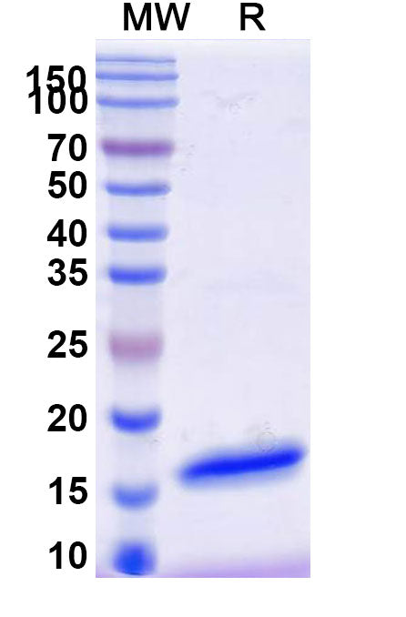 SDS-PAGE for Anti-GFP Nanobody (SAA1151)