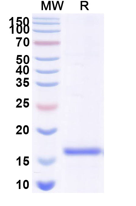 SDS-PAGE for Anti-GFP Nanobody (SAA0976)
