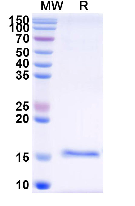 SDS-PAGE for Anti-African clawed frog nup54.S/Nup54 Nanobody (SAA1183)