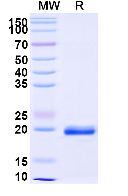 SDS-PAGE for Anti-African clawed frog Nup54 Nanobody (SAA0873)