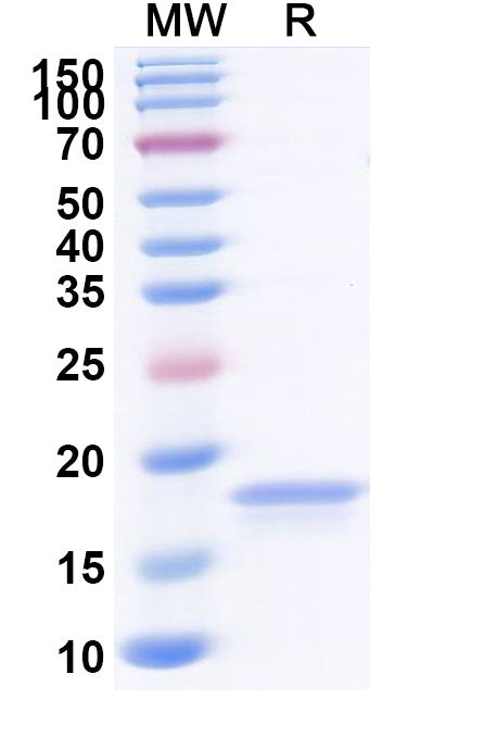 SDS-PAGE for Anti-African clawed frog Nucleoporin Nup58/54/62 Nanobody (SAA0872)