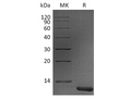 Recombinant Human S100A11 Protein – Figure 1 of 2