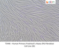 Human Primary Friedriech's Ataxia (FA) Fibroblast Cell Line 281 – Figure 1 of 1