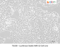 Luciferase Stable IMR-32 Cell Line – Figure 1 of 1